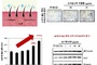 국내 자생 보리밥나무, 탈모예방 효과 확인