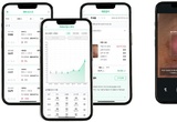 ㈜파인헬스케어, AI 기반 욕창 단계평가 ‘스키넥스 욕창’ 혁신의료기기 의료혁신군 지정