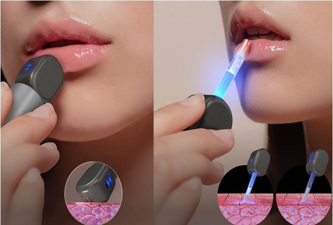 CES 2024 디지털 헬스(Digital Health) 부문에서 수상한 아모레퍼시픽의 '립큐어빔(LipcureBeam)'은 하나의 기기로 입술 진단과 케어, 메이크업이 모두 가능한 신개념 뷰티테크 디바이스다.